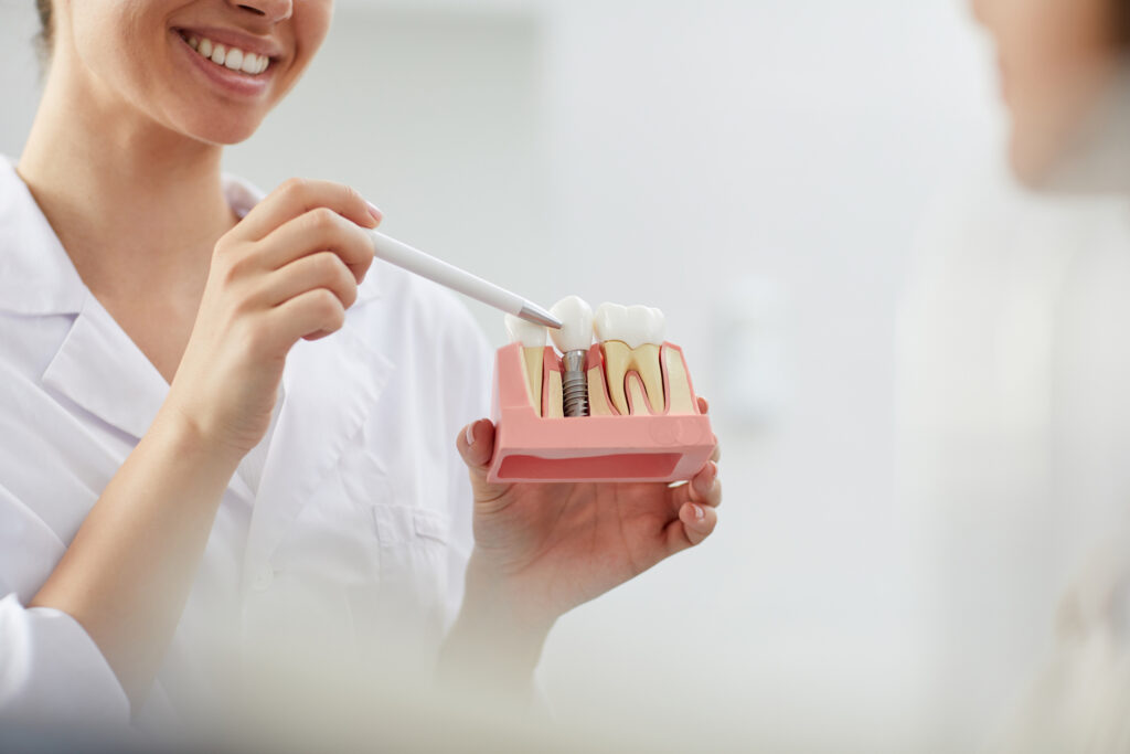 implantes dentales en pacientes jóvenes