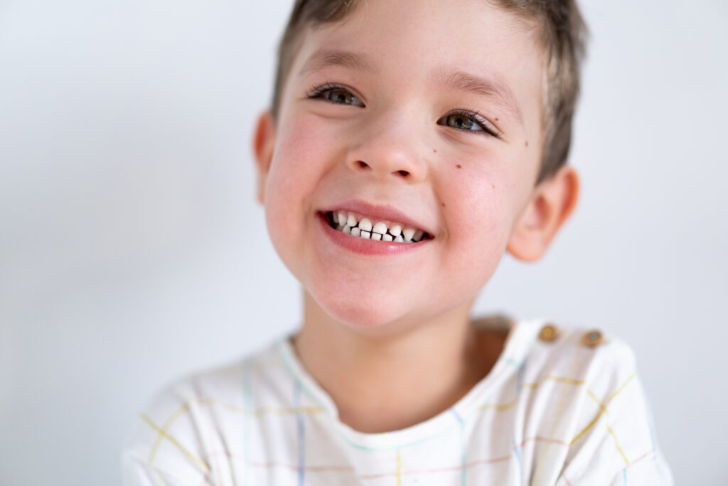 dientes de leche con caries
