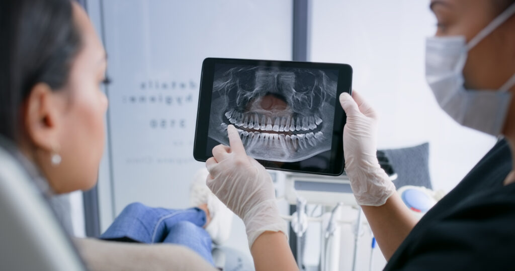 fractura dental