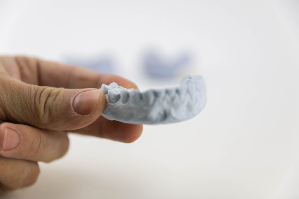 maloclusión dental
